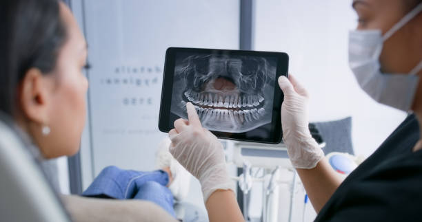 Licensed Dental Veneers service in Lake Belvedere Estates, FL - Smile Center Dentistry